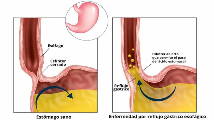 imagen-cuerpo