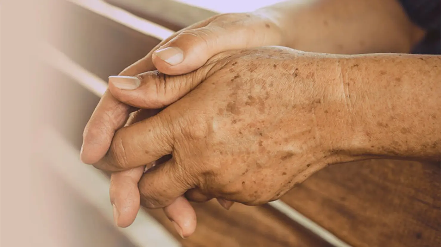 ¿Son por la edad? Esto significan las manchas cafés en las manos