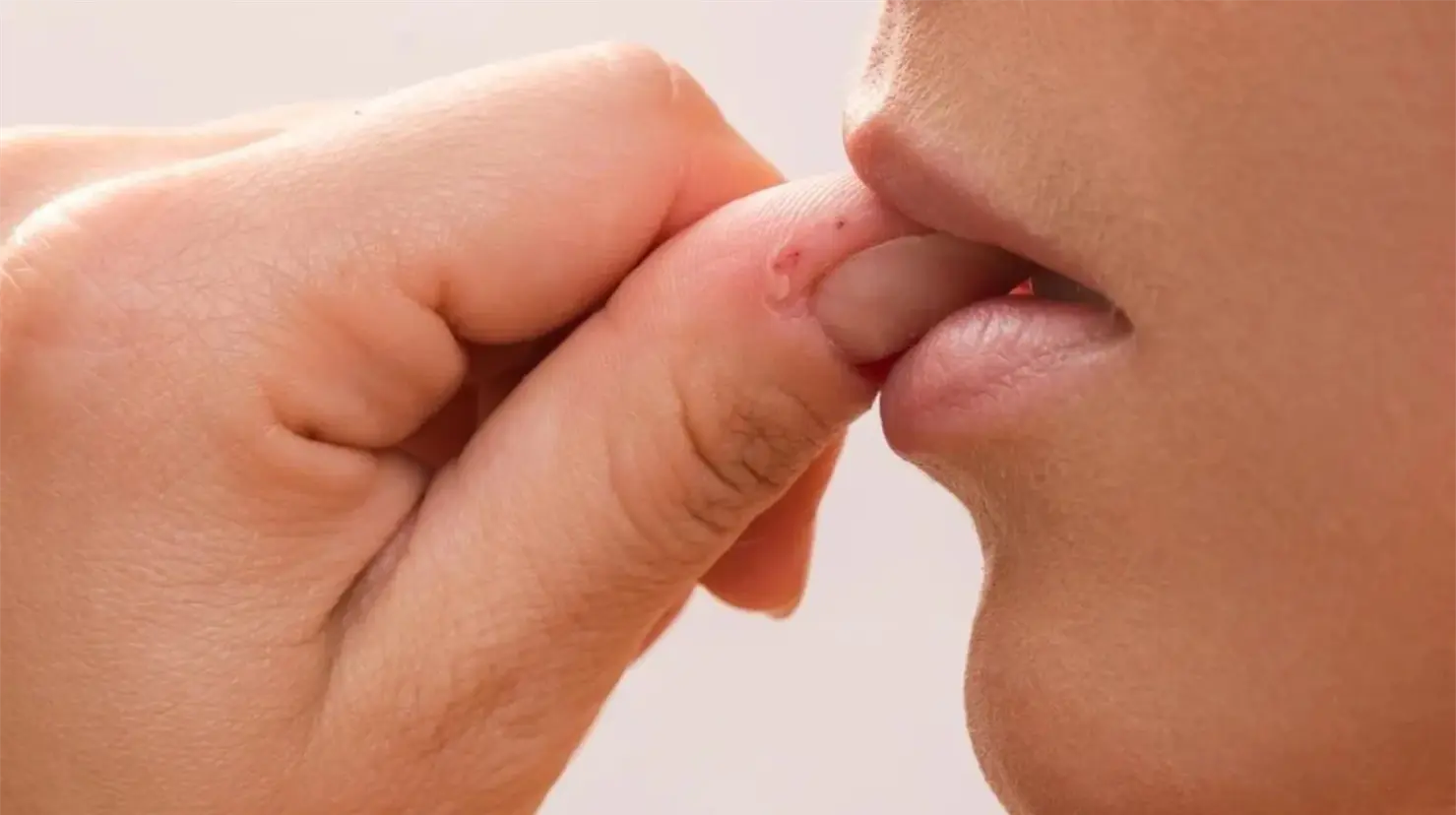 ¿Onicofagia es un trastorno? La verdad sobre el hábito de morderse las uñas
