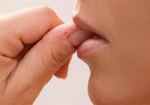 ¿Onicofagia es un trastorno? La verdad sobre el hábito de morderse las uñas