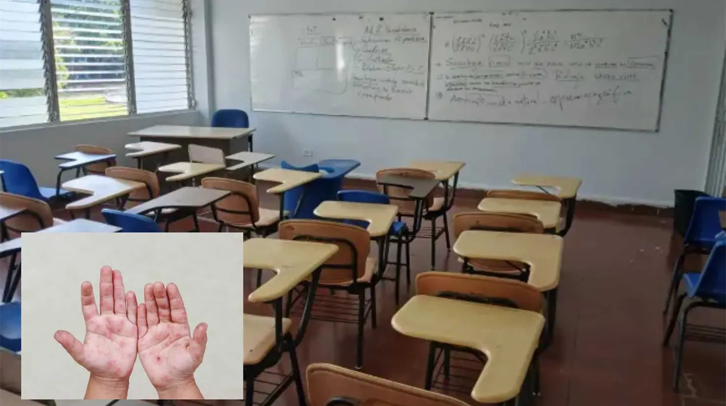 Suspenden clases en Baja California por brote del virus Coxsackie 