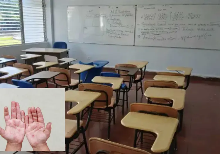 Suspenden clases en Baja California por brote del virus Coxsackie 