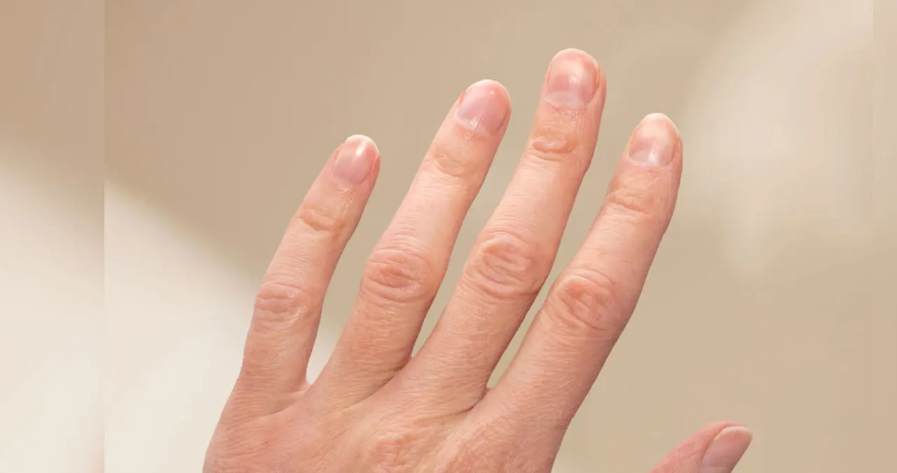Las uñas normalmente crecen alrededor de 0.1 mm por día, lo que equivale a 2 a 3 mm por mes.