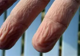 Esta es la verdadera razón detrás de las arrugas que se forman en la piel cuando te mojas