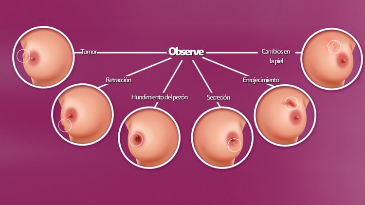 imagen-cuerpo imagen-cuerpo