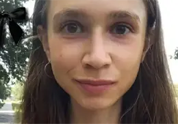 Influencer vegana extrema fallece a los 27 años; pesaba tan solo 22 kilos