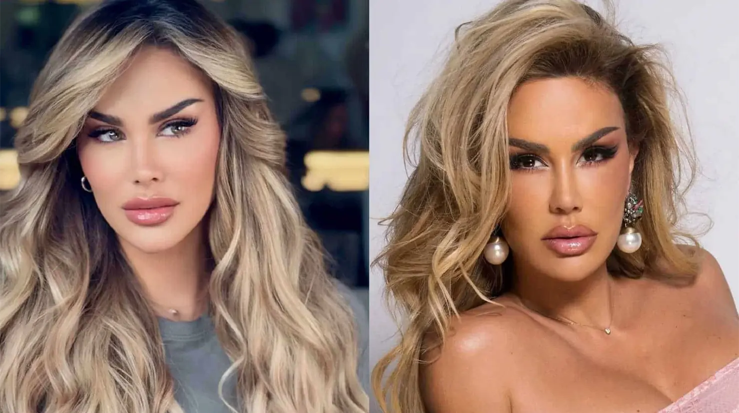 Ninel Conde se somete a cirugía de cambio de color de ojos: ¿Cómo es y cuáles son los riesgos?