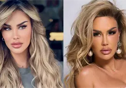 Ninel Conde se somete a cirugía de cambio de color de ojos: ¿Cómo es y cuáles son los riesgos? Ninel Conde se somete a cirugía de cambio de color de ojos: ¿Cómo es y cuáles son los riesgos?