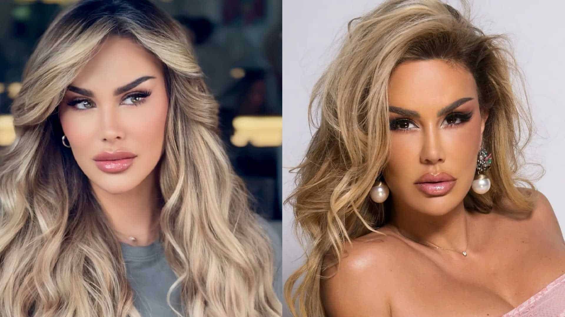 Ninel Conde se somete a cirugía de cambio de color de ojos: ¿Cómo es y cuáles son los riesgos?