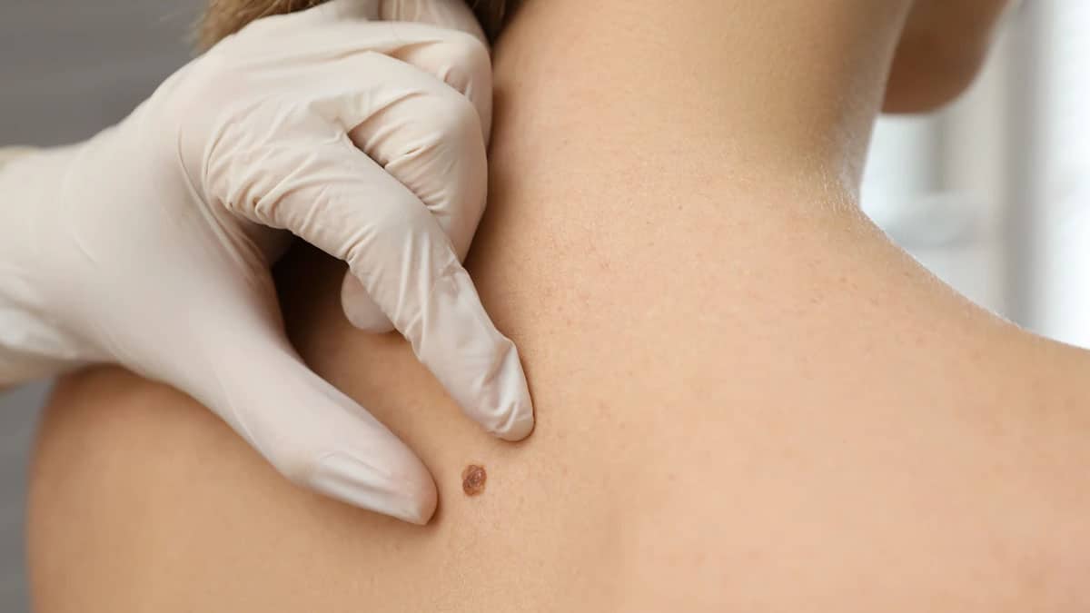 Instituto Nacional de Cancerología garantiza atención con plan de desarrollo