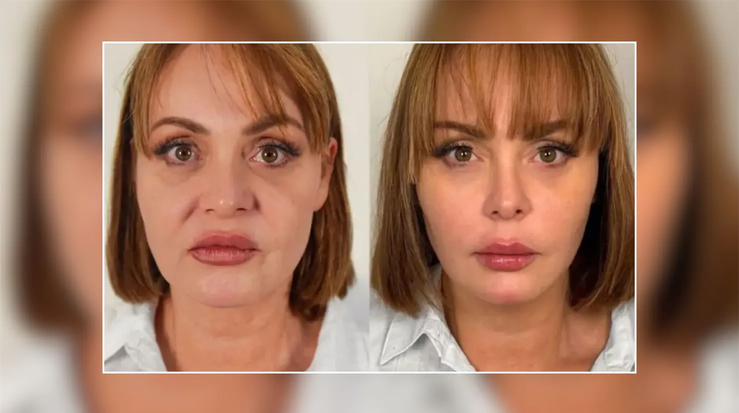 Gaby Spanic impacta con nuevo rostro y redes sociales señala que "parece 20 años más joven"