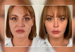 Gaby Spanic impacta con nuevo rostro y redes sociales señala que "parece 20 años más joven" Gaby Spanic impacta con nuevo rostro y redes sociales señala que "parece 20 años más joven"