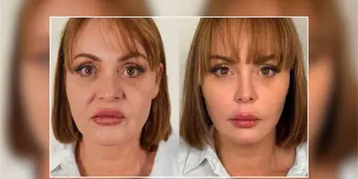 Gaby Spanic impacta con nuevo rostro y redes sociales señala que "parece 20 años más joven" Gaby Spanic impacta con nuevo rostro y redes sociales señala que "parece 20 años más joven"