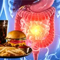 Estudio vincula consumo de alimentos ultraprocesados con aumento de cáncer de colon en jóvenes Estudio vincula consumo de alimentos ultraprocesados con aumento de cáncer de colon en jóvenes