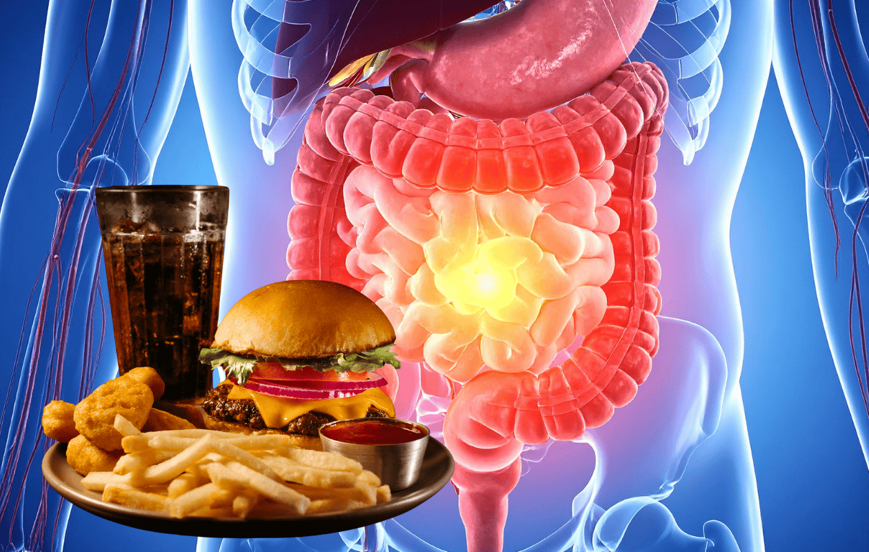 Estudio vincula consumo de alimentos ultraprocesados con aumento de cáncer de colon en jóvenes