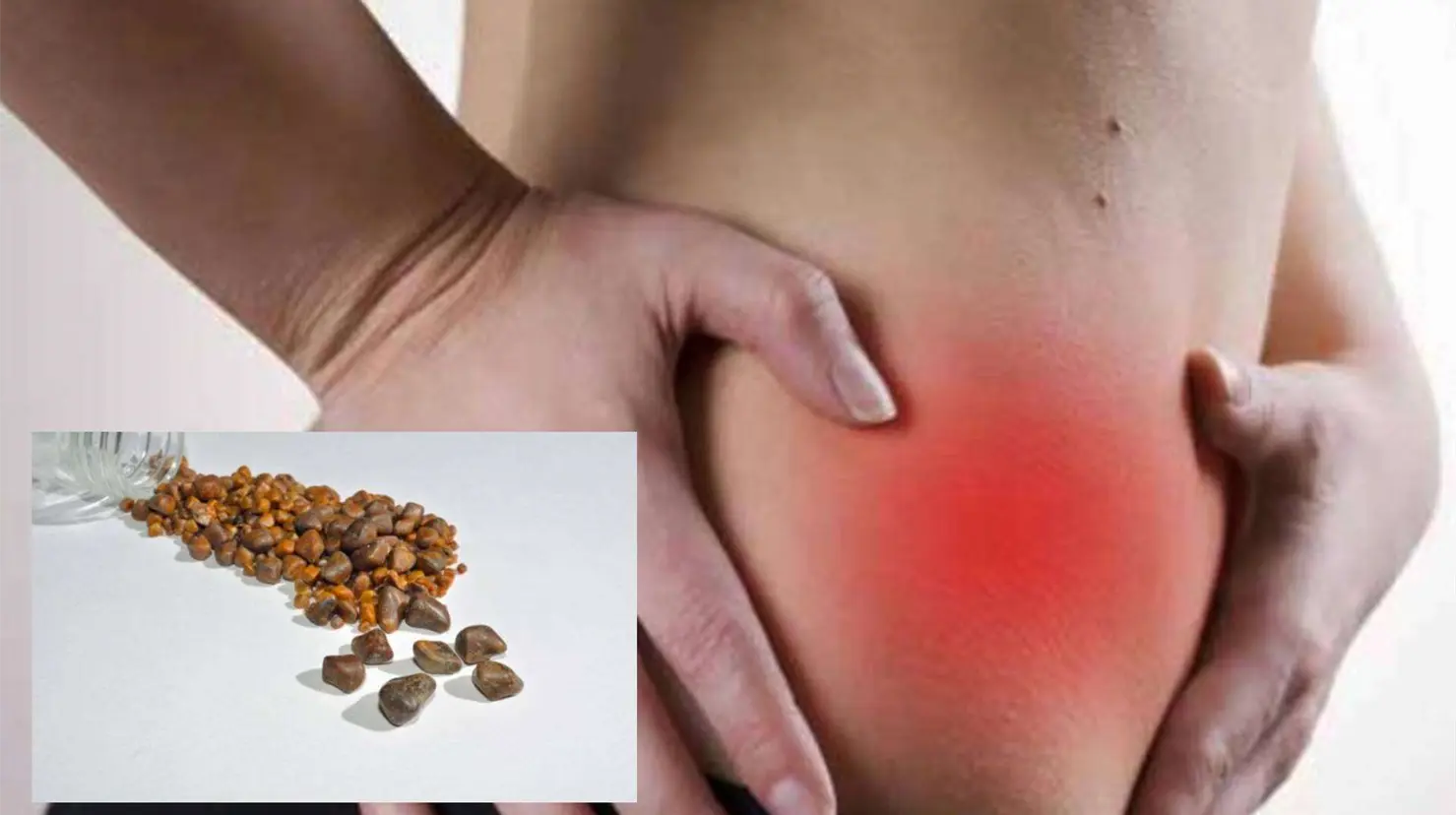 Piedras en la Vesícula: Las complicaciones fatales que podrías desencadenar al ignorar las señales