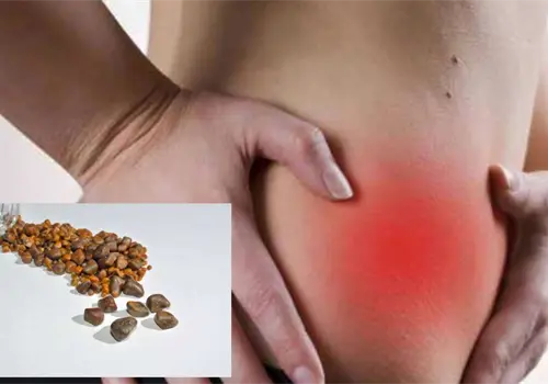 Piedras en la Vesícula: Las complicaciones fatales que podrías desencadenar al ignorar las señales Piedras en la Vesícula: Las complicaciones fatales que podrías desencadenar al ignorar las señales