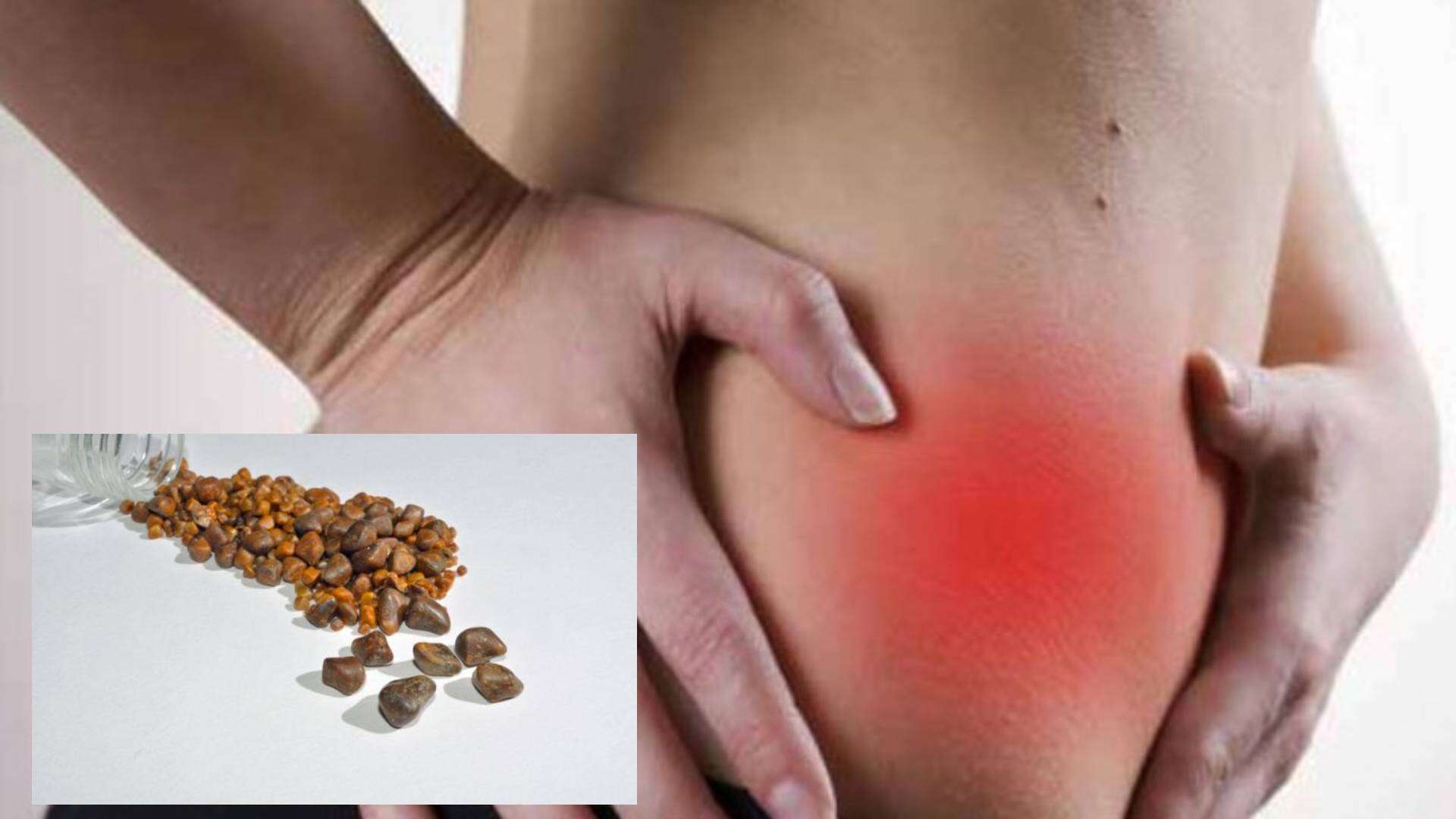 Piedras en la Vesícula: Las complicaciones fatales que podrías desencadenar al ignorar las señales