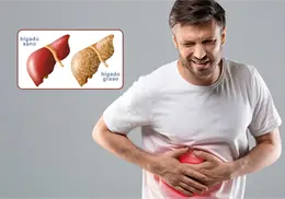 Hígado graso: Los 5 síntomas más comunes que te alertan de esta enfermedad silenciosa