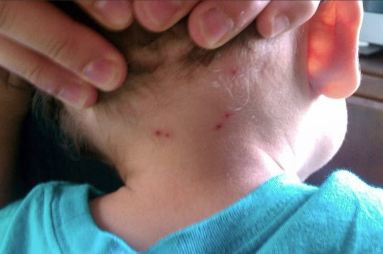 imagen-cuerpo imagen-cuerpo