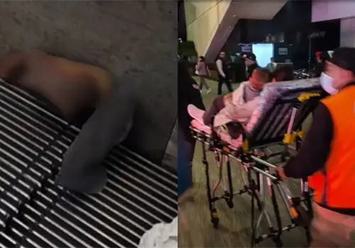 Menor de edad pierde extremidad tras quedar atrapado en escaleras el&eacute;ctricas