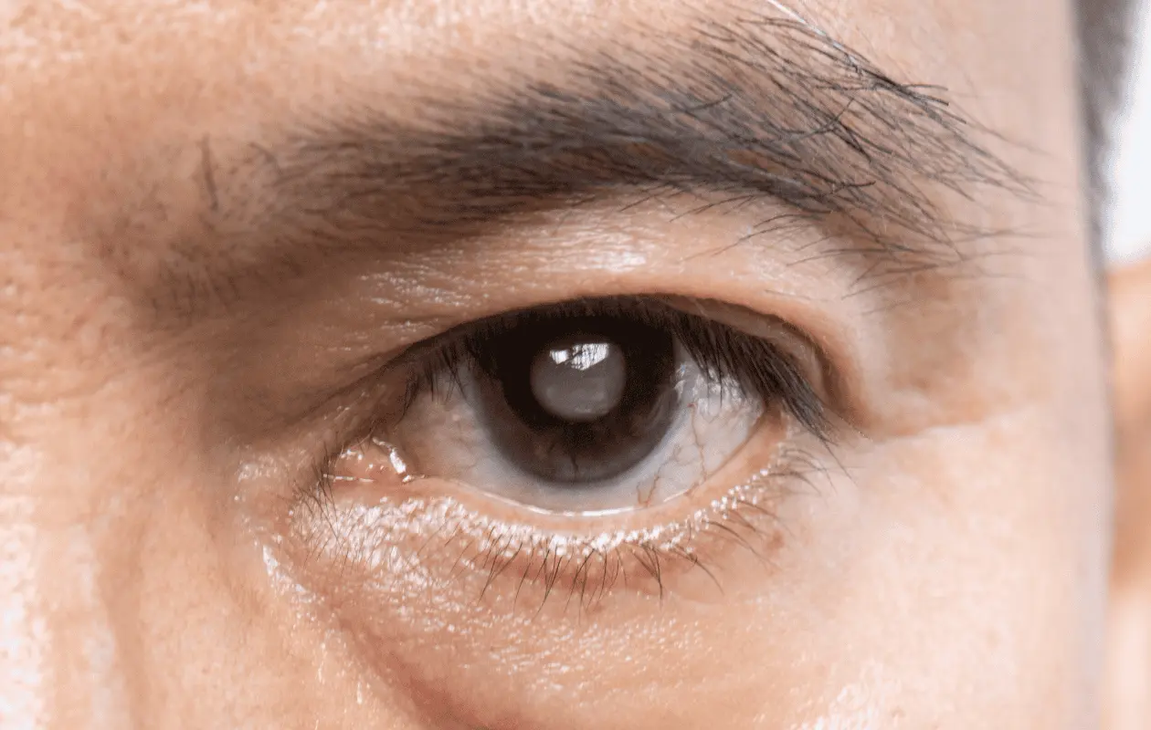 En México, representan el 34 por ciento de los casos de ceguera.