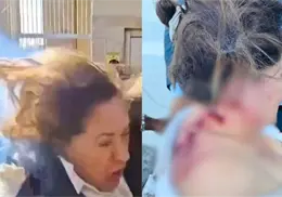 VIDEO l Atacan con explosivo a diputada en Honduras; presenta lesiones en espalda y cuello