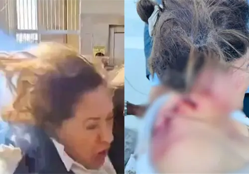 VIDEO l Atacan con explosivo a diputada en Honduras; presenta lesiones en espalda y cuello