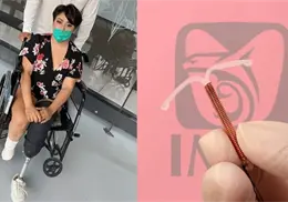Acude al IMSS para retirarse el DIU y termina perdiendo ambas piernas: ¿qué fue lo que salió mal? Acude al IMSS para retirarse el DIU y termina perdiendo ambas piernas: ¿qué fue lo que salió mal?