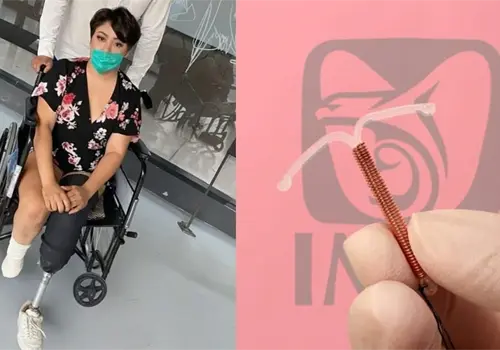 Acude al IMSS para retirarse el DIU y termina perdiendo ambas piernas: ¿qué fue lo que salió mal? Acude al IMSS para retirarse el DIU y termina perdiendo ambas piernas: ¿qué fue lo que salió mal?