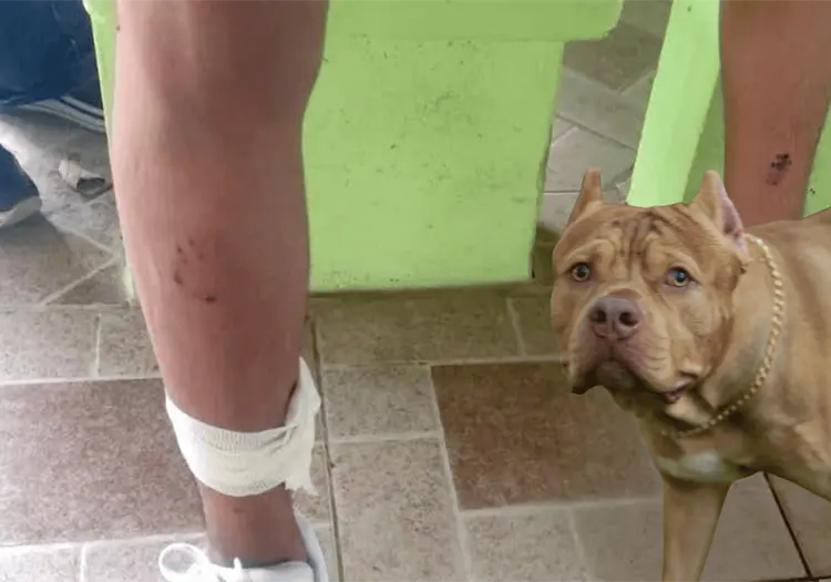 Ataque de perros pitbull deja siete estudiantes heridos en secundaria de Veracruz