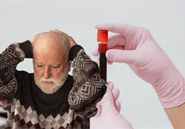 Prueban an&aacute;lisis de sangre para detectar Alzheimer m&aacute;s temprano