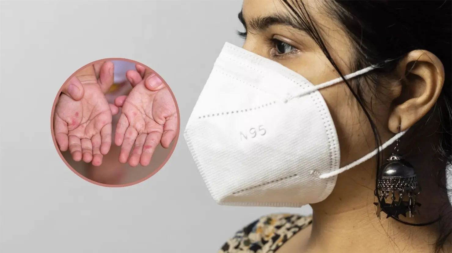 &iquest;Cu&aacute;les son los cubrebocas recomendados para protegerse del brote de sarampi&oacute;n?