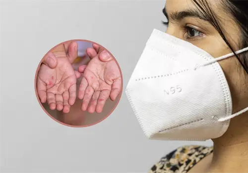 &iquest;Cu&aacute;les son los cubrebocas recomendados para protegerse del brote de sarampi&oacute;n?