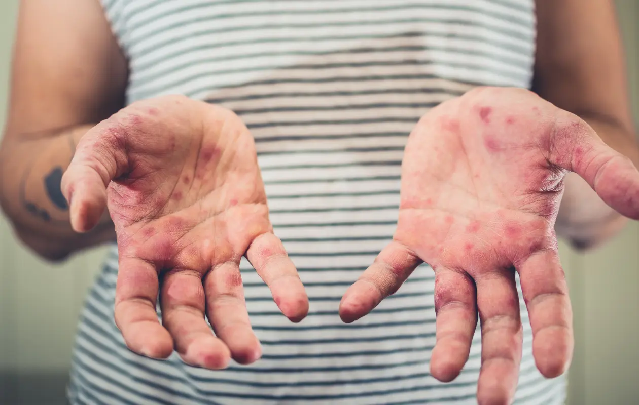 En algunas entidades se han establecido medidas fuertes para evitar m&aacute;s contagios.